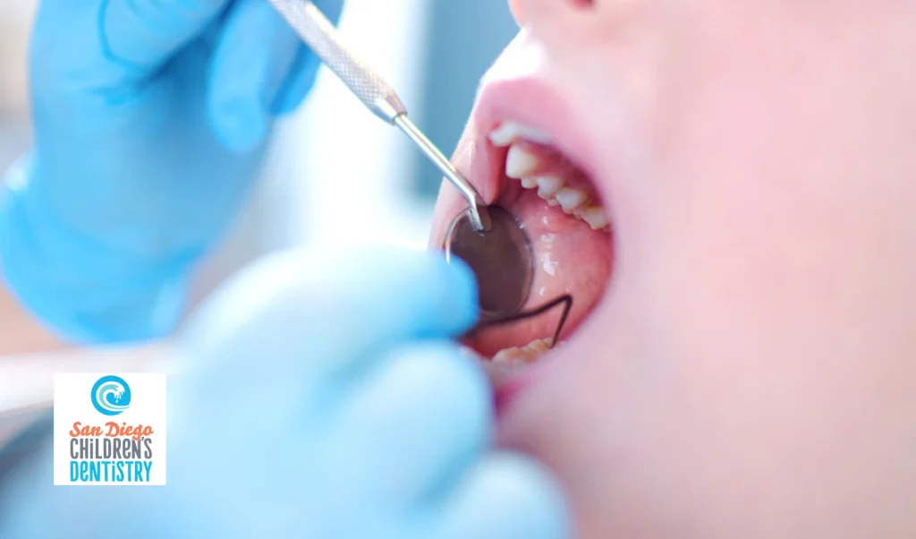 Checking Teeth, Gums, and Oral Development
