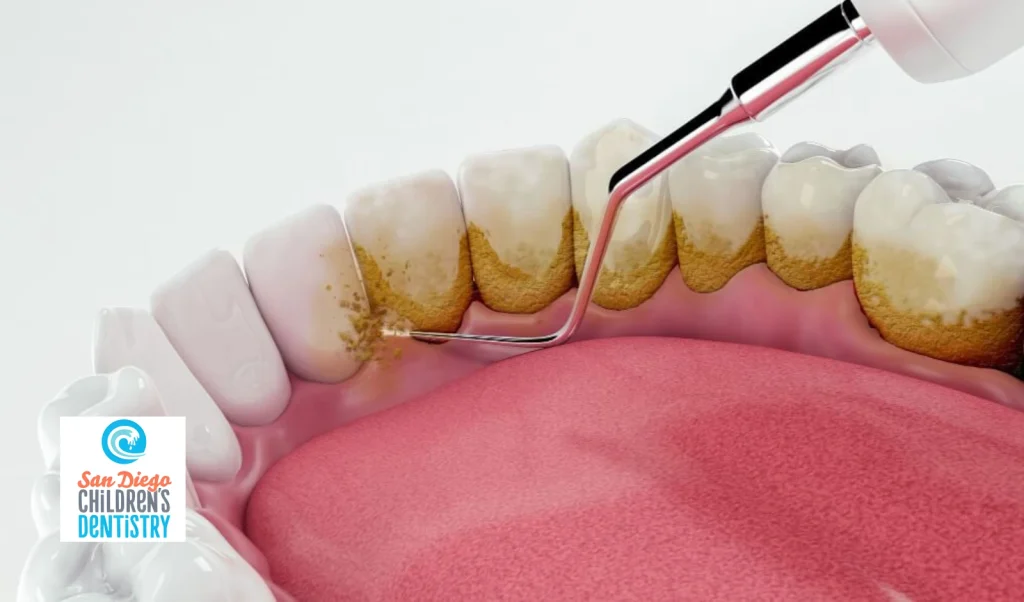 Dental Cleaning and Plaque Removal
