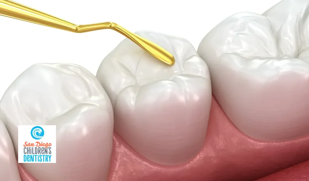 Benefits of Dental Sealants for Kids