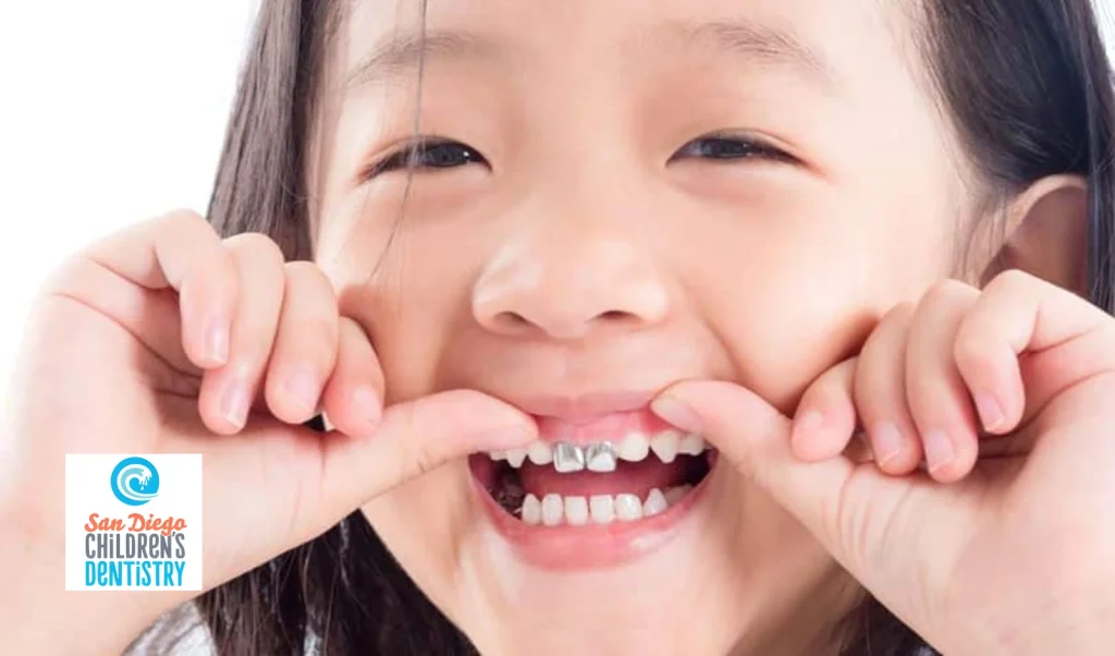 Step-by-Step Dental Sealant Procedure
