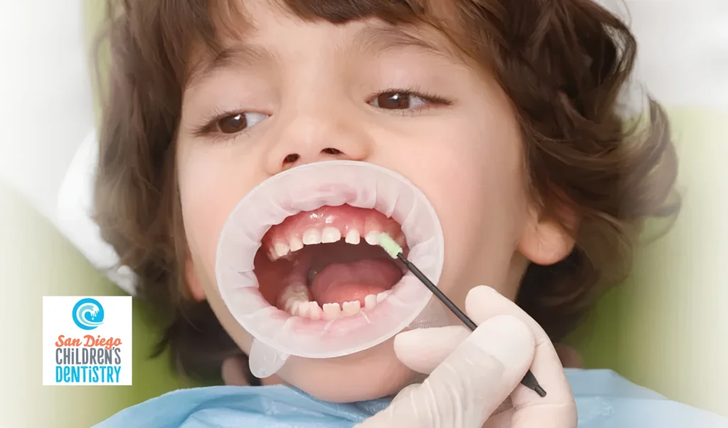 What Is Fluoride Care